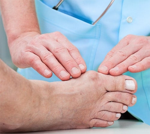 Guide To Common Toe Deformities Canyon Oaks Foot And Ankle Fresno