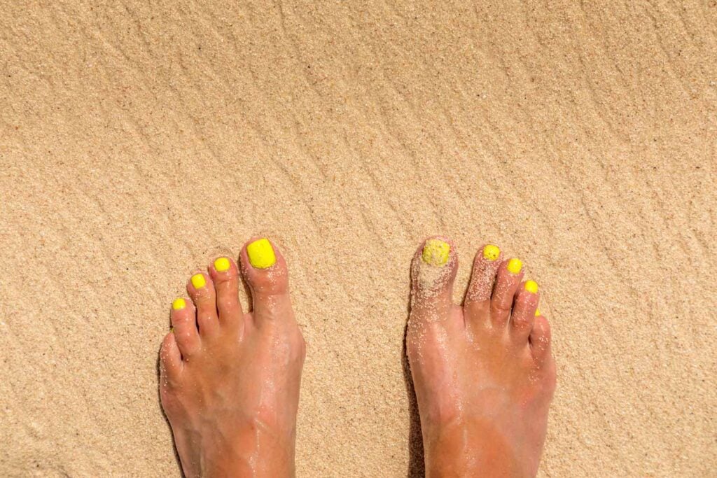 an example of how to get rid of Yellow Toenails