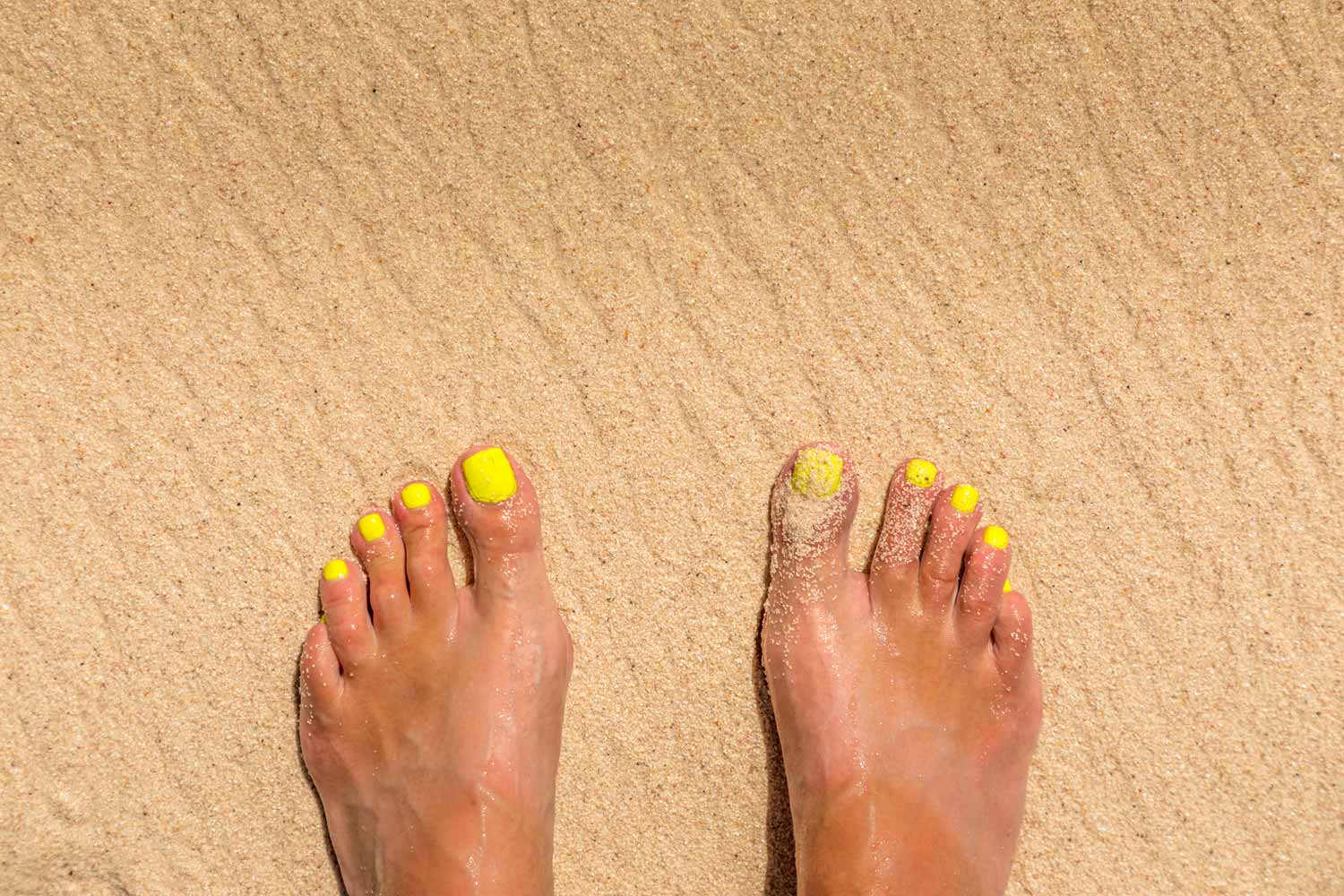 yellow toenails