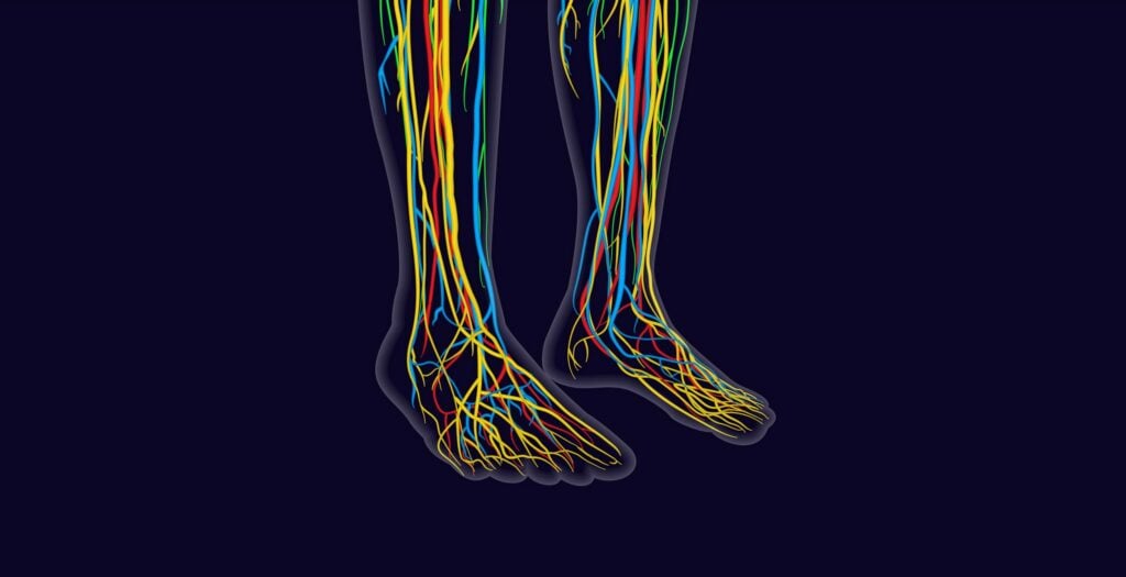 infograph of a Guide to nerve pain in heel